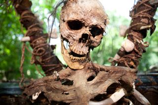 Image of decaying human remains.