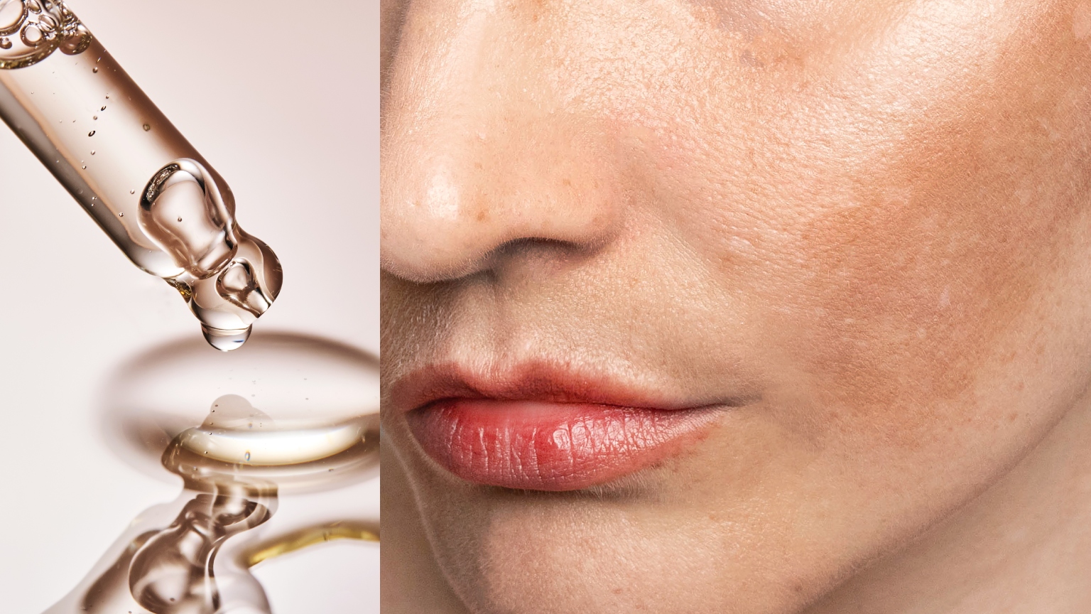a woman#039;s skin with melasma close up next to a clear dropper of serum