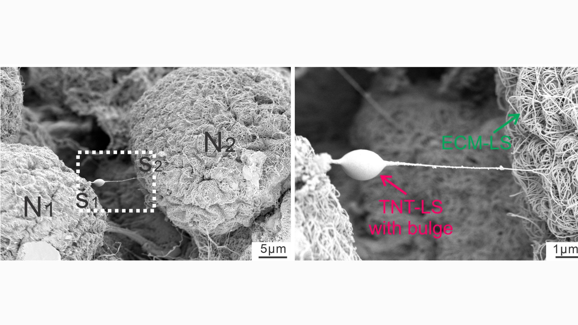 two images show a nerve cell with a tiny tube extending from its surface. a bulge in the tube indicates something is inside it