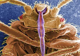 A bedbug, as seen under a scanning electron microscope. The insect's blood-sucking mouthparts show up in purple. Although bedbugs live on blood, there is no evidence they can effectively spread blood borne disease. Aside from the stigma associated with th