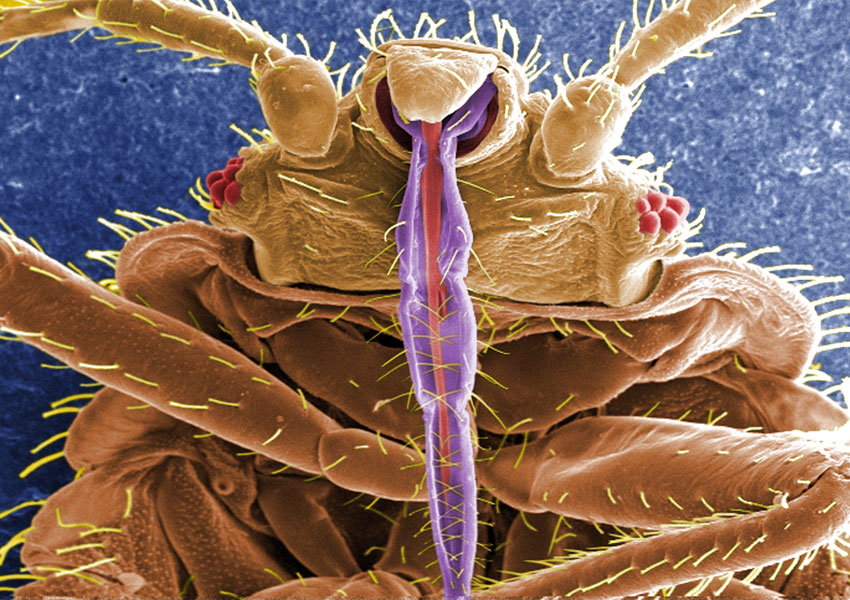 microscopic bed bugs