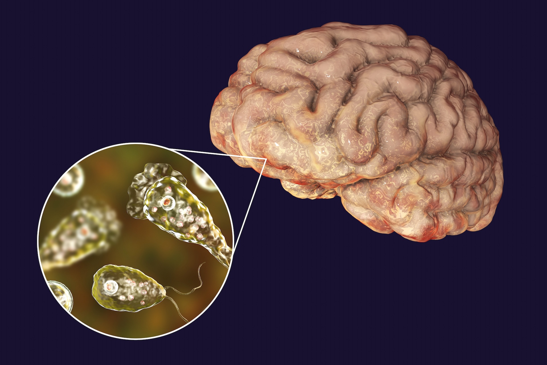 A scientific illustration showing a brain and a close-up of amoebas of the species Naegleria fowleri