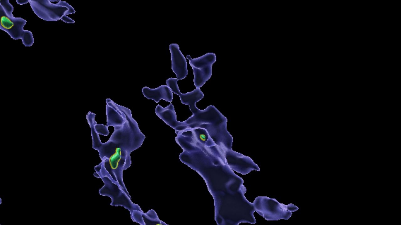  Microplastics that accumulate in the body may clog up immune cells 