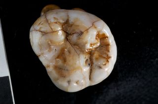 Denisovan molar