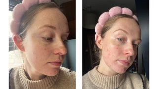 an image of beauty writer annie before and after cleansing her face with luna 4