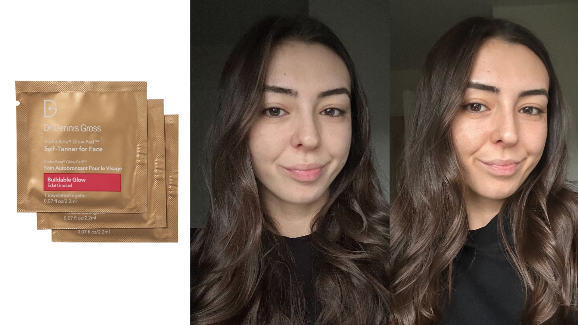 On the left, an image of the Dr. Dennis Gross Alpha Beta Glow Pad Self Tanner for Face, middle image shows Sennen before using the tanning pads and on the right shows the results of the Dr. Dennis Gross Alpha Beta Glow Pad Self Tanner for Face