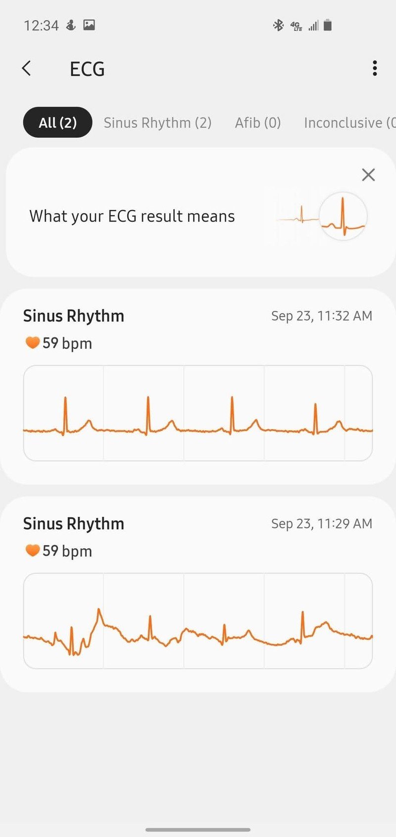 Samsung Health Monitoring Ecg