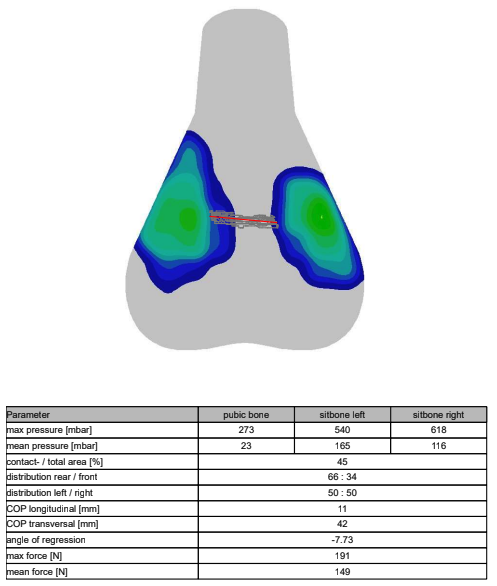 A visual output of saddle pressure mapping