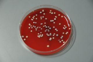 Bacteria from human skin grown on agar in the laboratory.