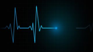 An electrocardiogram line showing a person's heartbeat and then a flat line for death.