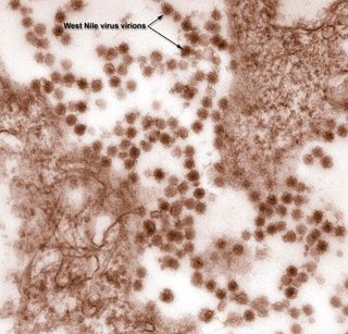 This transmission electron micrograph (TEM) revealed the presence of West Nile virus virions in an isolate that was grown in a cell culture.