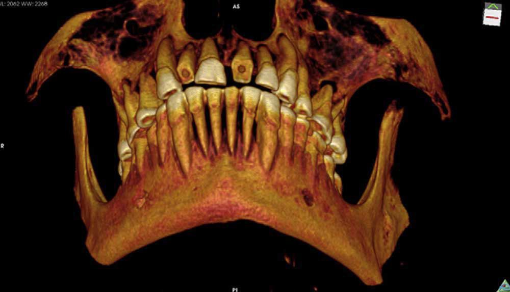 ancient egyptian mummy teeth