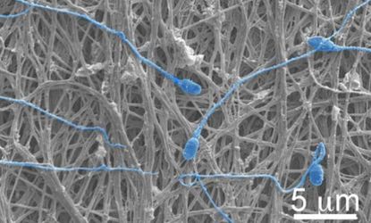 The condom of the future could be made of electrospun fibers that can block sperm, as well as release antiviral drugs. 