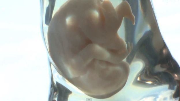 A model of your unborn child