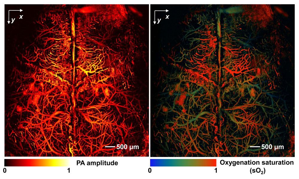 Mouse brain ffPAM