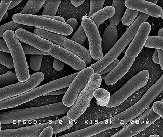 A scanning electron microscope's view of Escherichia coli bacteria.
