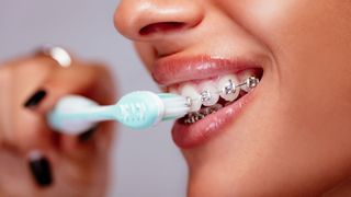 Can you use an electric toothbrush with braces: image shows woman cleaning braces