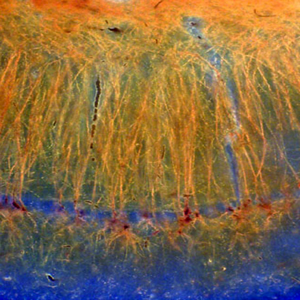 Pyramidal neurons in the CA1 hippocampal region. Their parallel organization and often synchronous cooperation can generate extracellular electric fields which, in turn, may influence their computation.