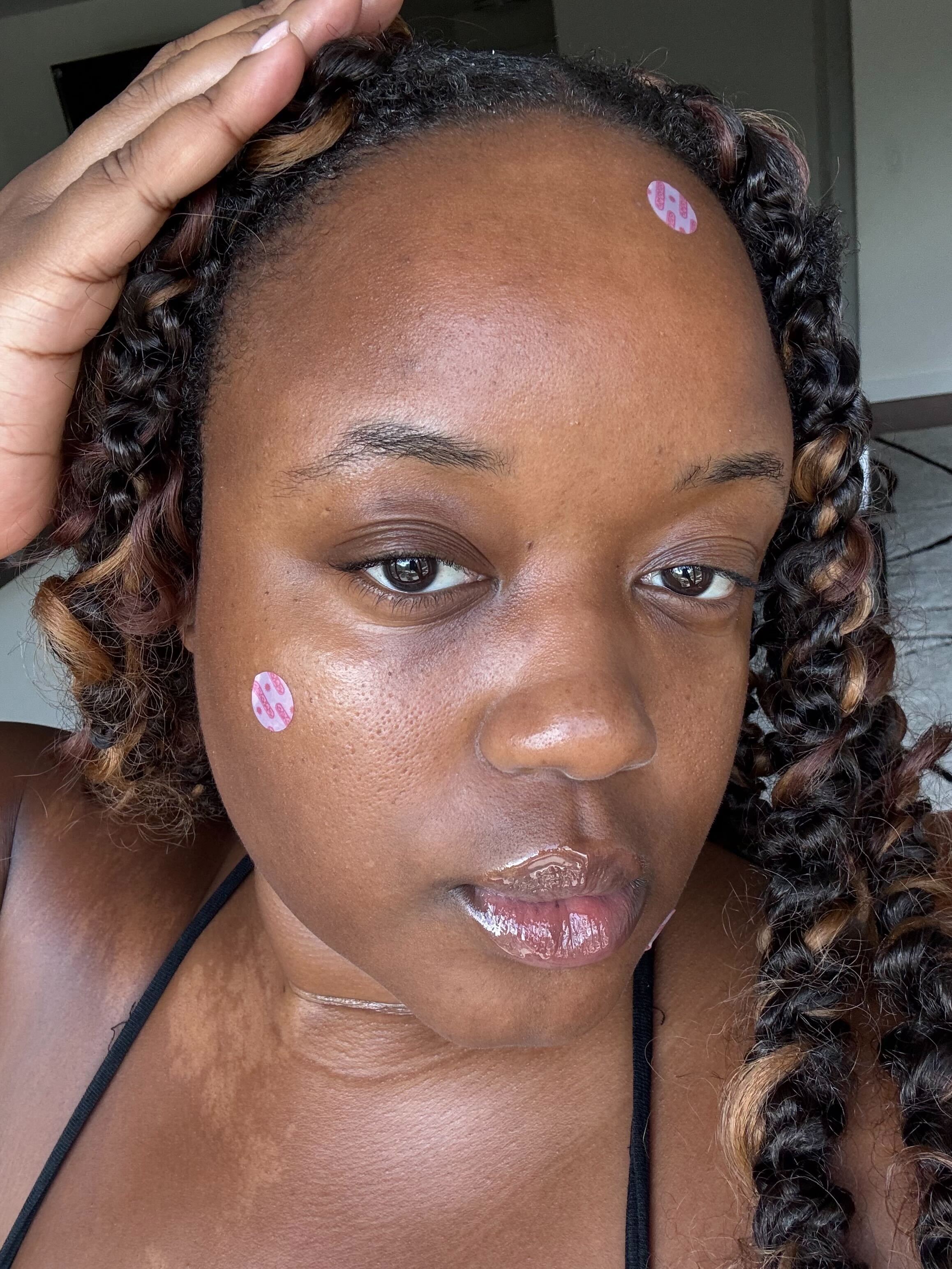 A woman with twists wearing the Topicals Faded Darkspot Stickers