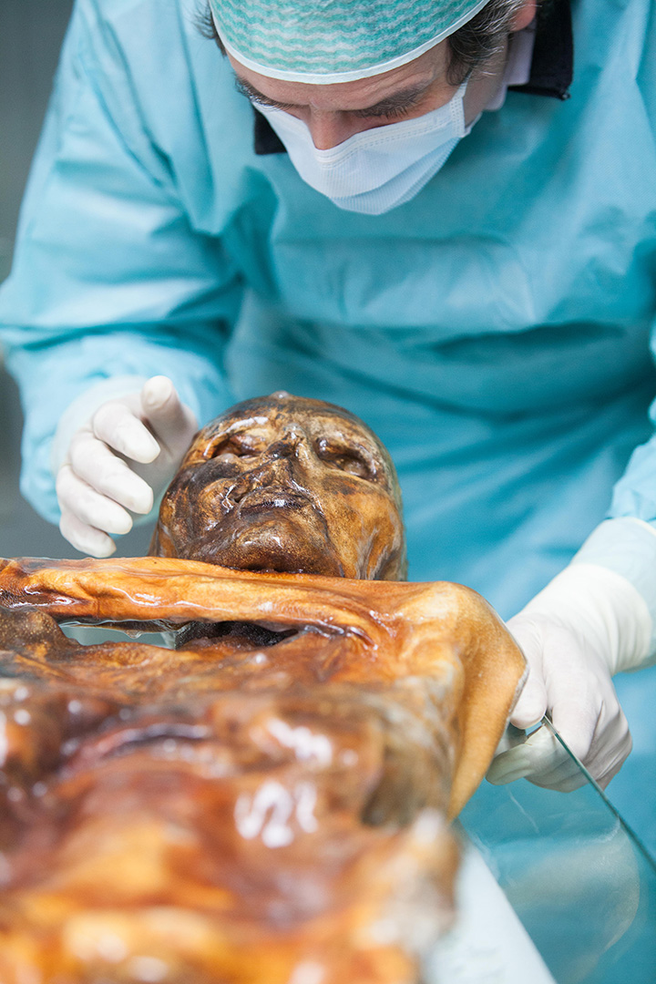 A close up of a mummy on a surgical table being examined by a person in a blue medical suit and white gloves.