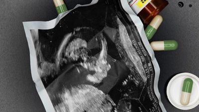 Baby scan and bottle of pills