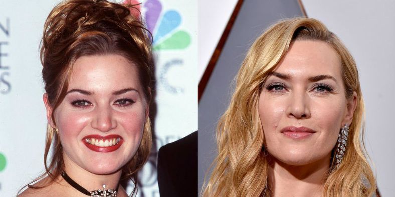 This Is What Your Favorite Celebrities Looked Like in Their 20s | Marie