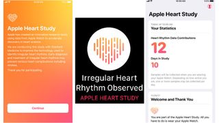 The Apple Watch is enabling large-scale research into heart conditions