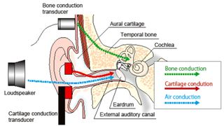a diagram of how bone conduction headphones work