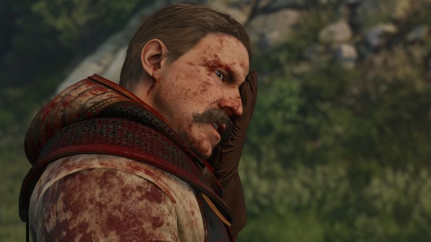 Kingdom Come: Deliverance 2 character Zizka holding his wounded eye