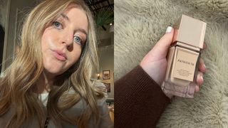 samantha holender wearing foundation for rosacea