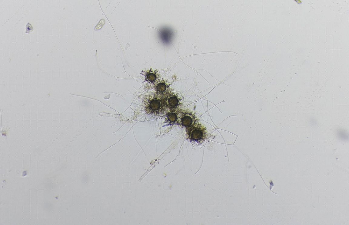 Raspberry Pi Captures Microscopic Wonders with HQ Camera | Tom's Hardware