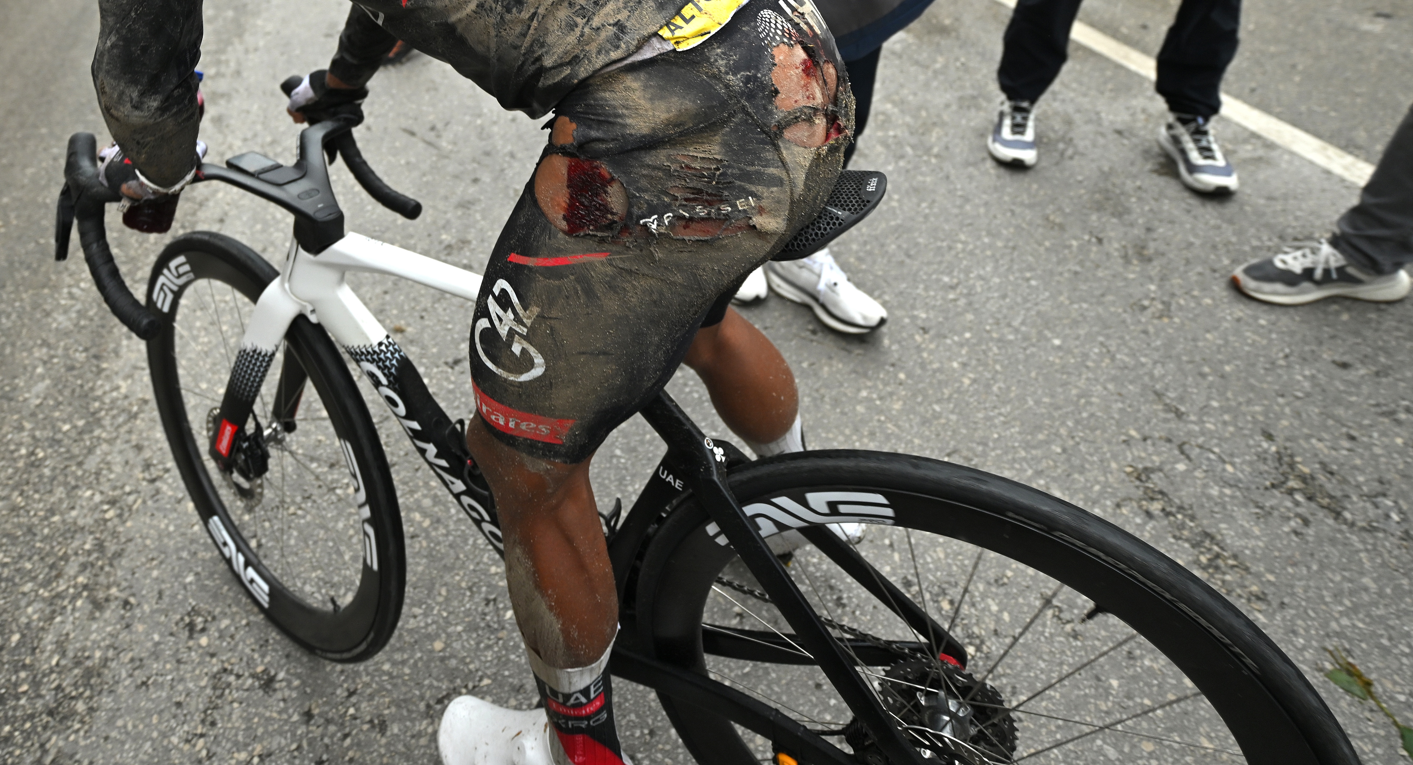 A view of Narvaez's torn up shorts from above