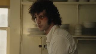 Anthony looking intensely with a black eye