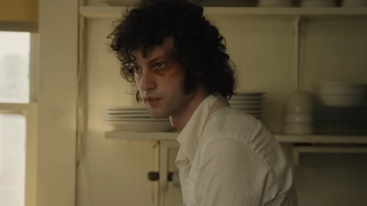 Anthony looking intensely with a black eye