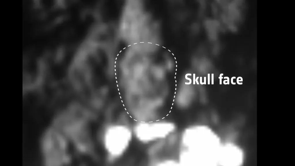 Europe's Philae comet lander made a 2nd touchdown in a spooky spot: 'Skull-Top Ridge'