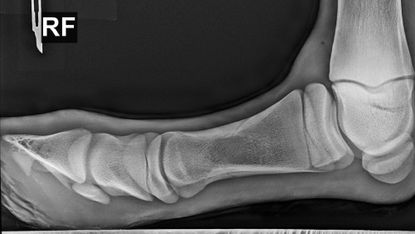 An X-ray showing a horse's leg at a right angle