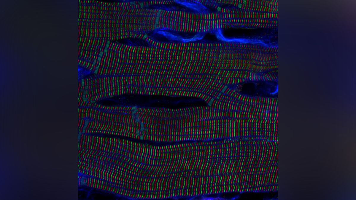 Microscopic image of rat heart cells.