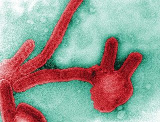 This colorized image shows a number of Marburg virus virions, as seen through a transmission electron microscope. Ebola viruses and Marburg virus both belong to the same family of viruses, called the filovirus family.
