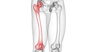 Computer illustration showing the femur, the human thigh bone, inside a body (image from hip to knee only).