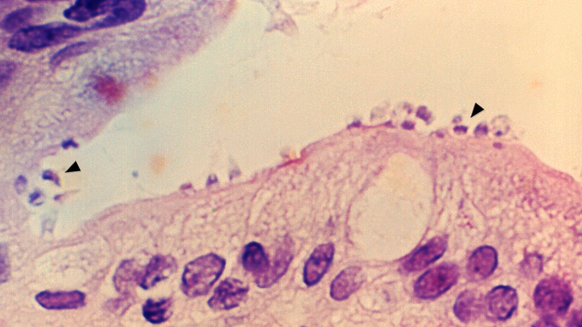 A picture of Cryptosporidium, the parasite that causes cryptosporidiosis.