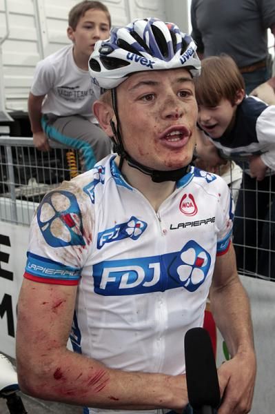 After burying himself in the four-man break for his FDJ teammate Yoann Offredo, it looks like Steve Chainel came to grief on the descent of the Poggio.
