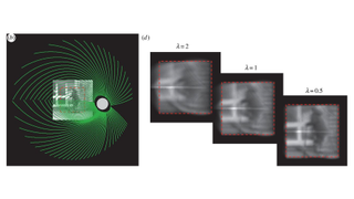 This is what the world looks like with a bionic eye