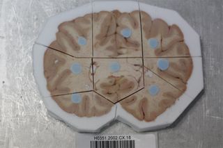 Human brain slice from the Allen Human Brain Atlas.