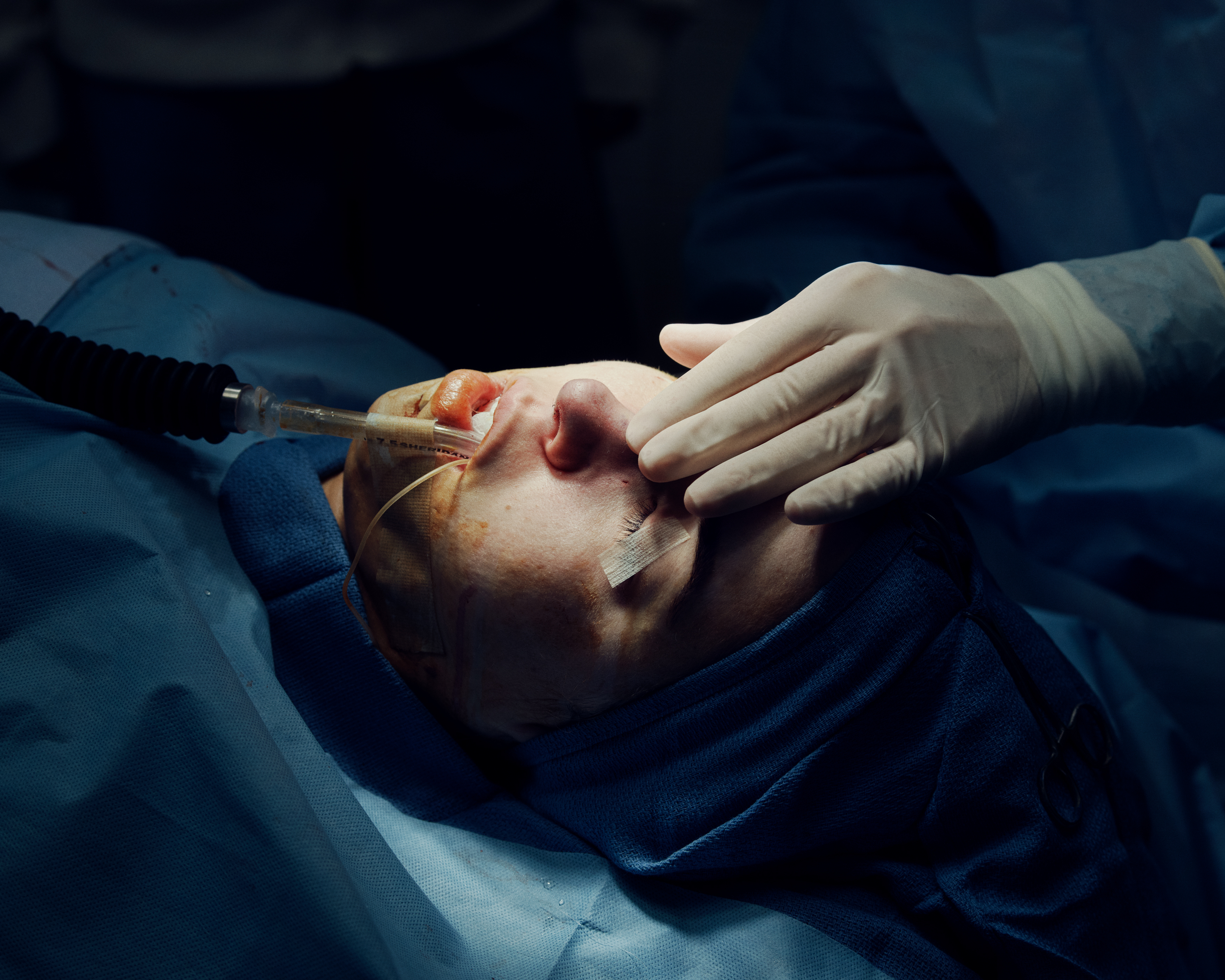 photography of person having surgery