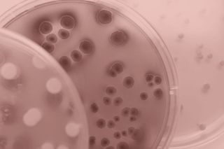 Three overlapping petri dishes with bacterial growth