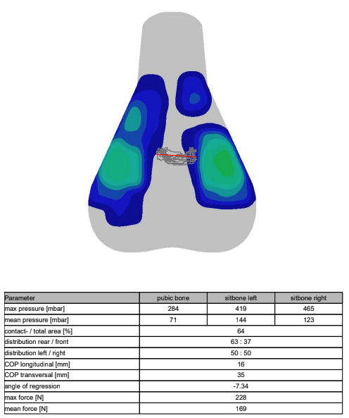 A visual output of saddle pressure mapping