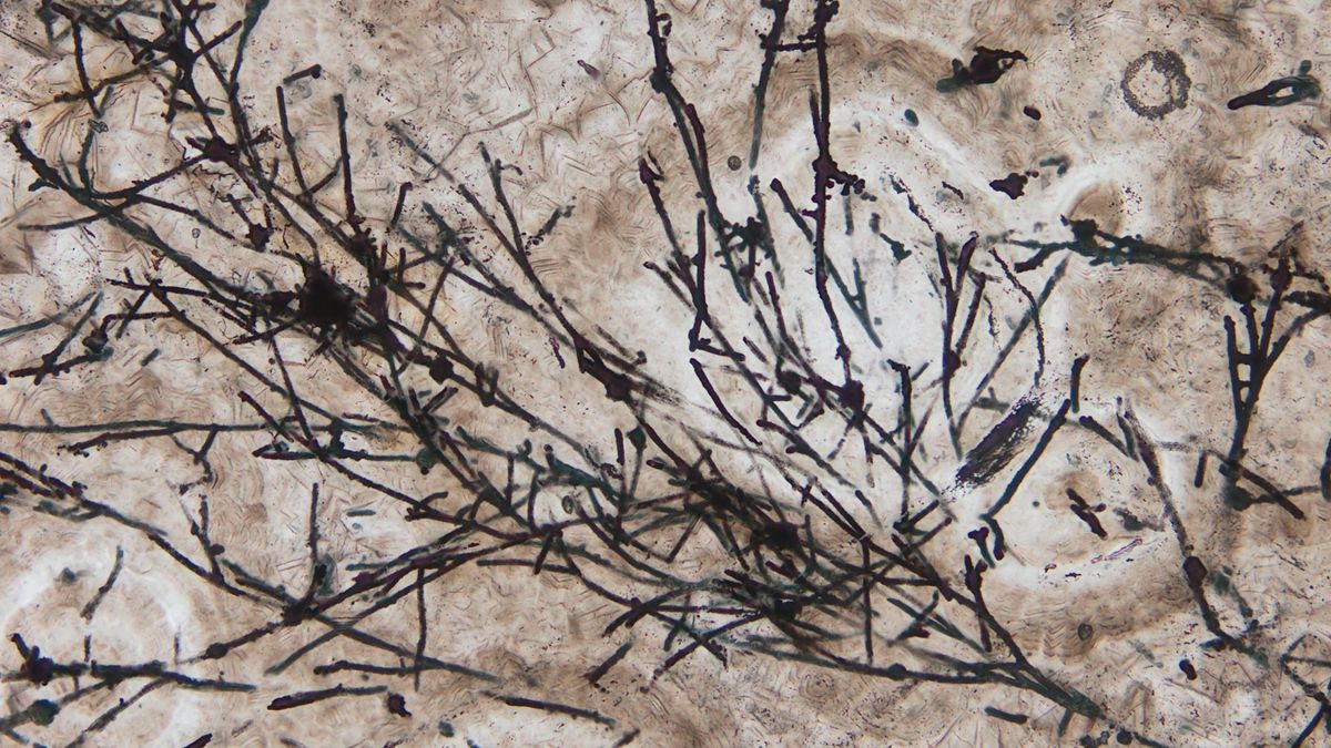 635 million year old fossil is the oldest known land fungus