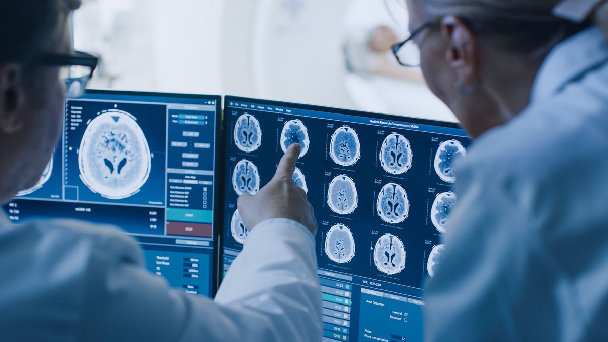 Medical professionals examining brain scans on a display