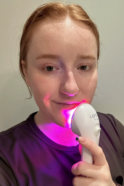 Danielle R., a 'Marie Claire' Tester, tests the LightStim for Acne LED Device