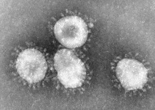 Coronaviruses, the family of viruses to which SARS belongs, are a group of viruses that have a crown-like (corona) appearance when viewed under an electron microscope.
